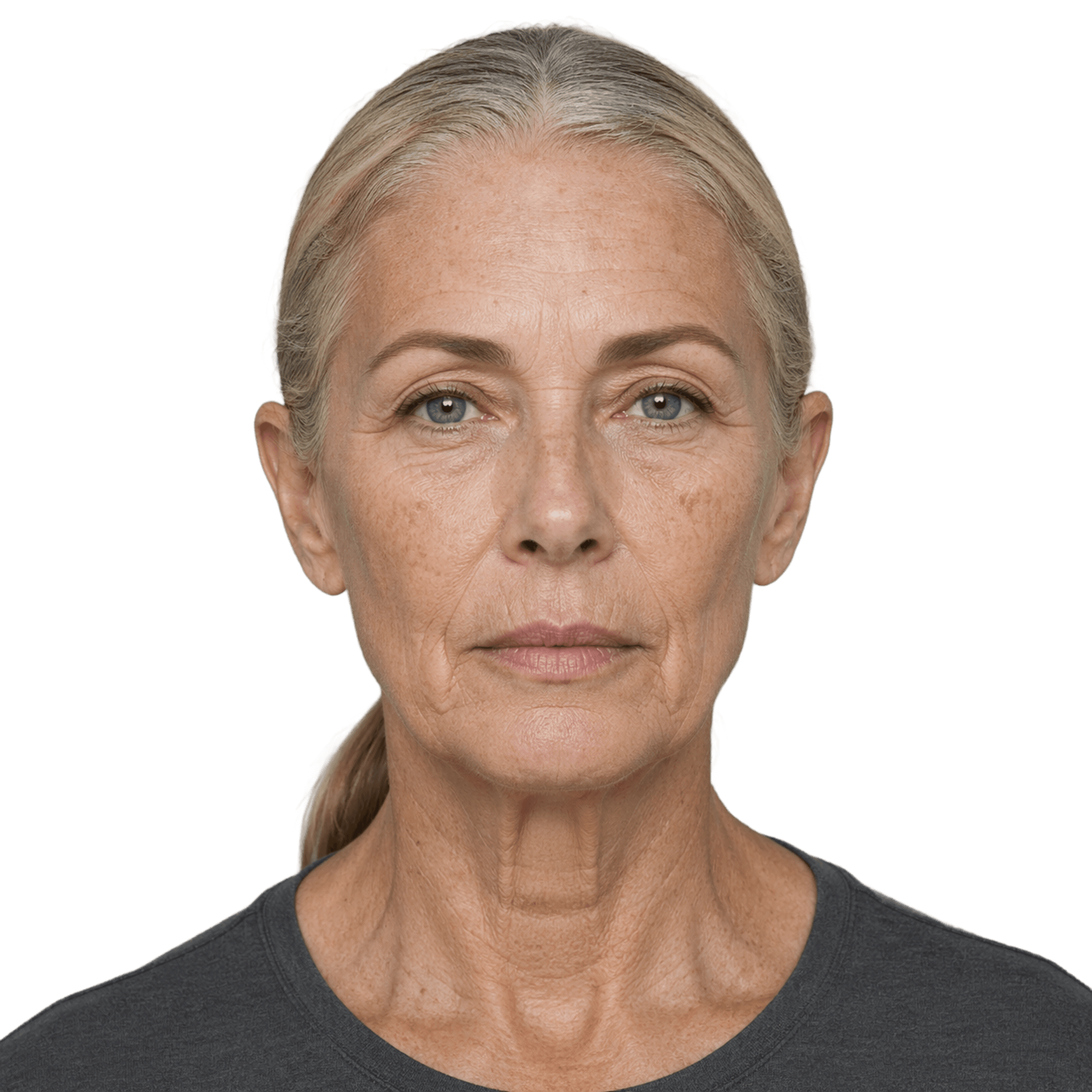 Before — current appearance